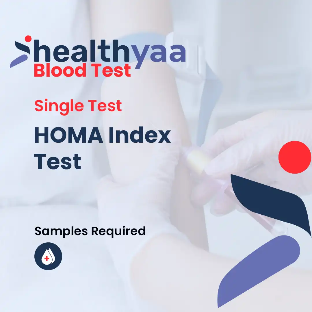 [INSR] HOMA Index Test